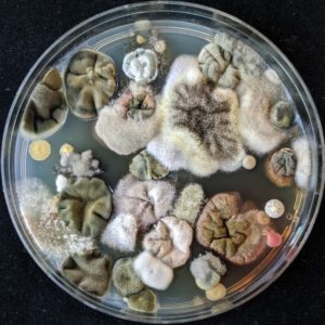 Fungal plate 1 300x300 - Microbiology Lab’s Clarity, Focus Get Boost Online